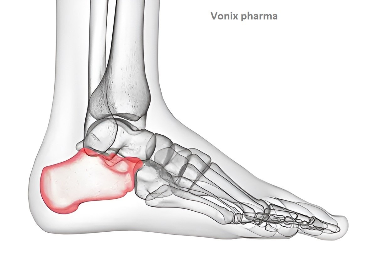 Calcaneus Conundrum Ankle Bones Crossword Enigma